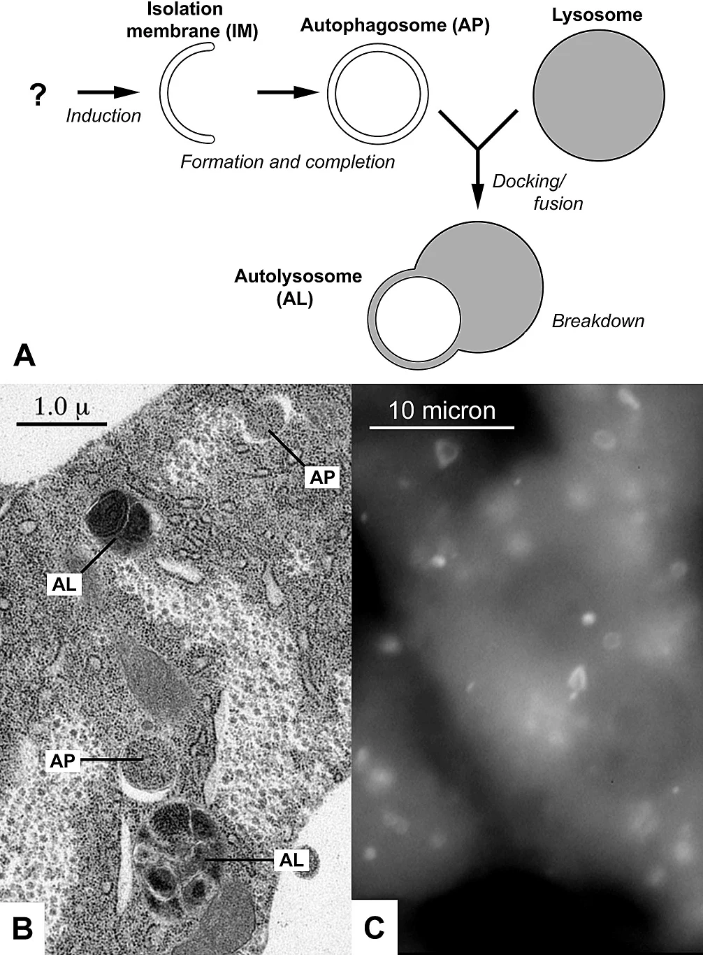 types of autophagy - zanfaraz