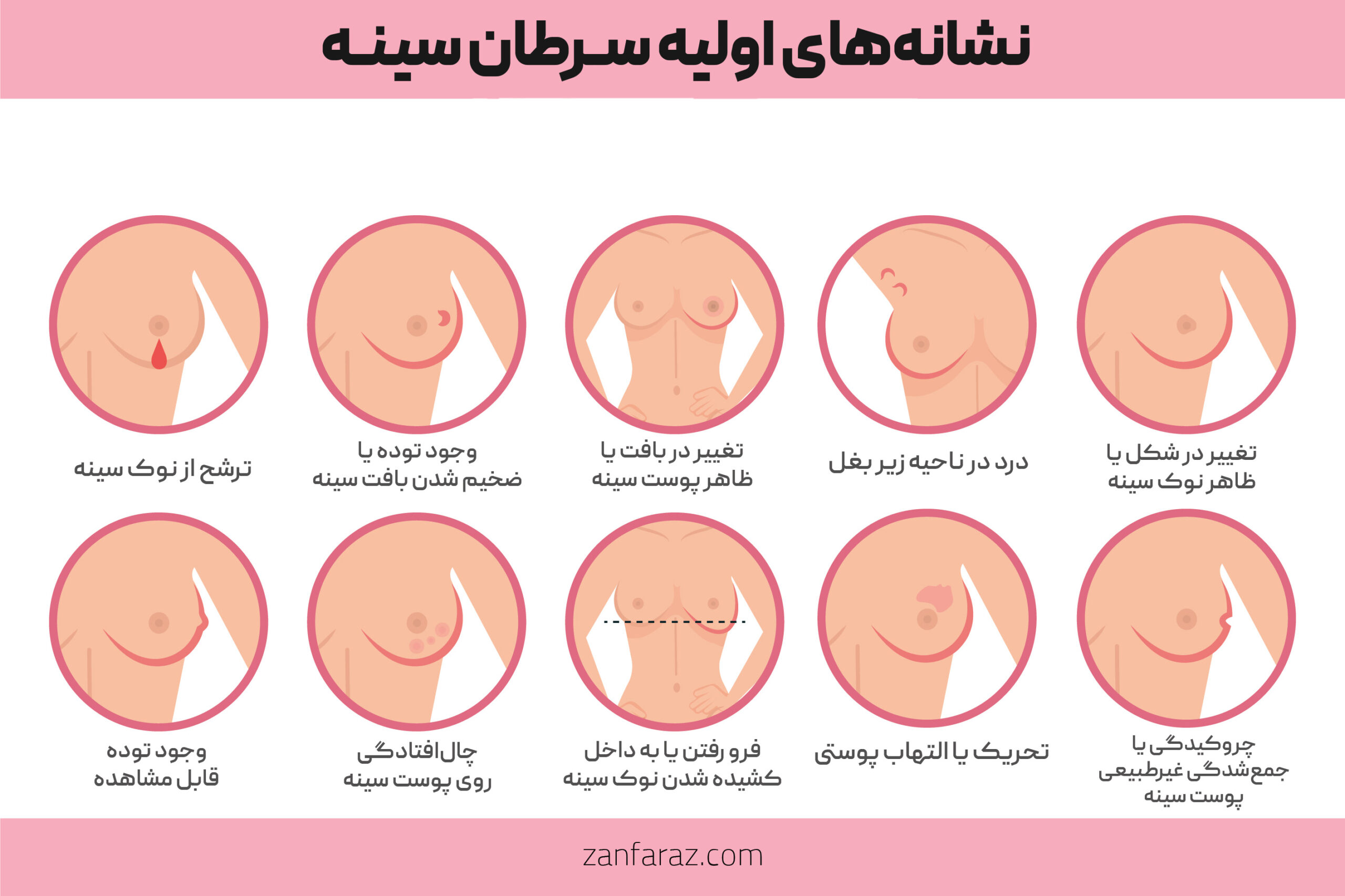 Early Signs of Breast Cancer - zanfaraz.com