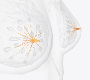 breast cancer - zanfaraz - holistic