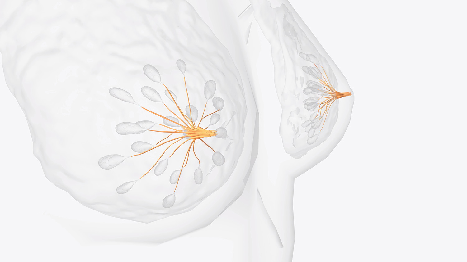 breast cancer - zanfaraz - holistic
