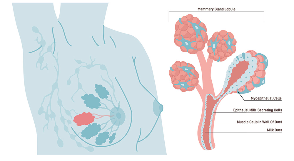 breast_duct_anatomy_zanfaraz.com - سرطان سینه