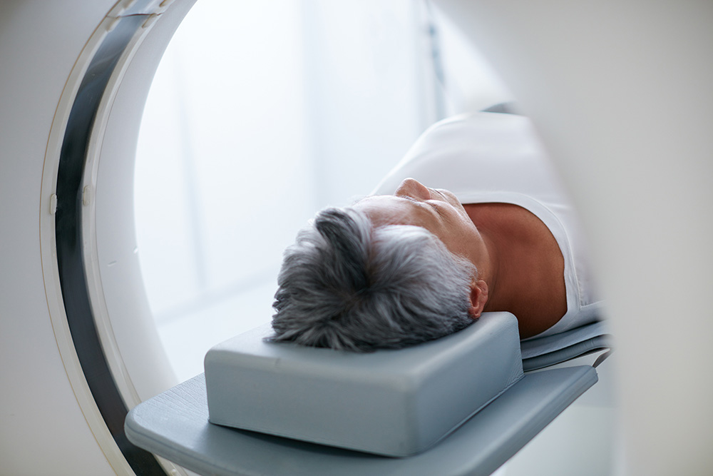 radiation therapy side effects - zanfaraz.com